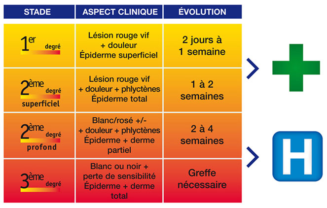 Comment Soigner Une Br lure Pharmacie Aubret Vial comment-soigner-une-br-lure-pharmacie-aubret-vial